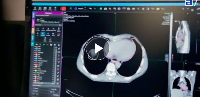 Un ingeniero asturiano participa en el proyecto de código abierto de Microsoft que utiliza Inteligencia Artificial para ayudar en el triaje de los casos de Covid
