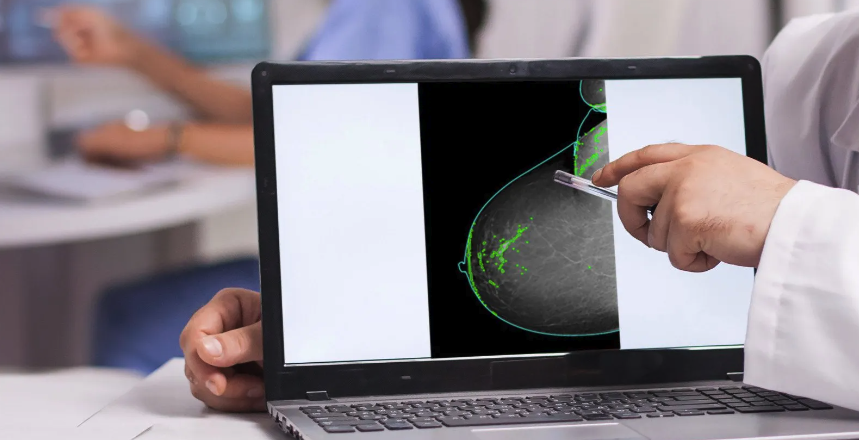 Tecnología que redefine la batalla contra el cáncer